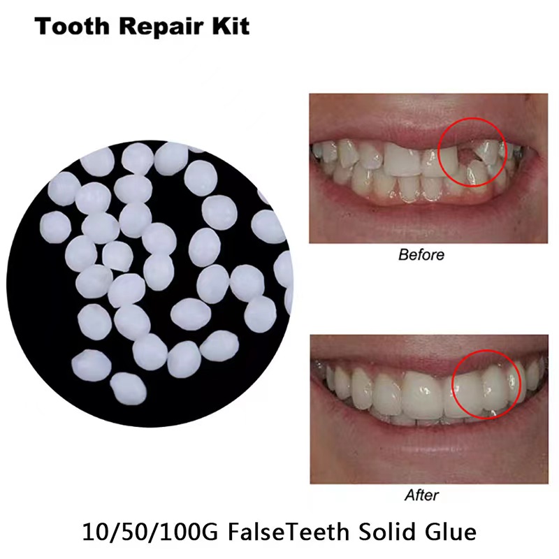 Teeth Whitening Mask - 10 g/zak Tandreparatieset-thermische kralen voor het