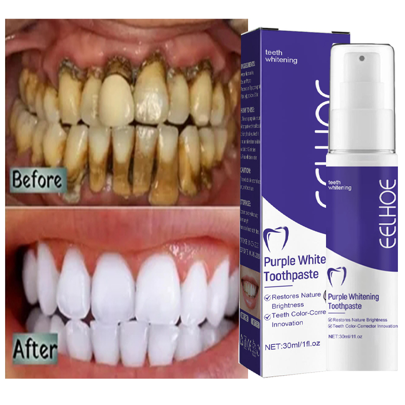 Teeth Whitening Korea - 1 Stuks Tanden Reinigen Tandpasta Bleken