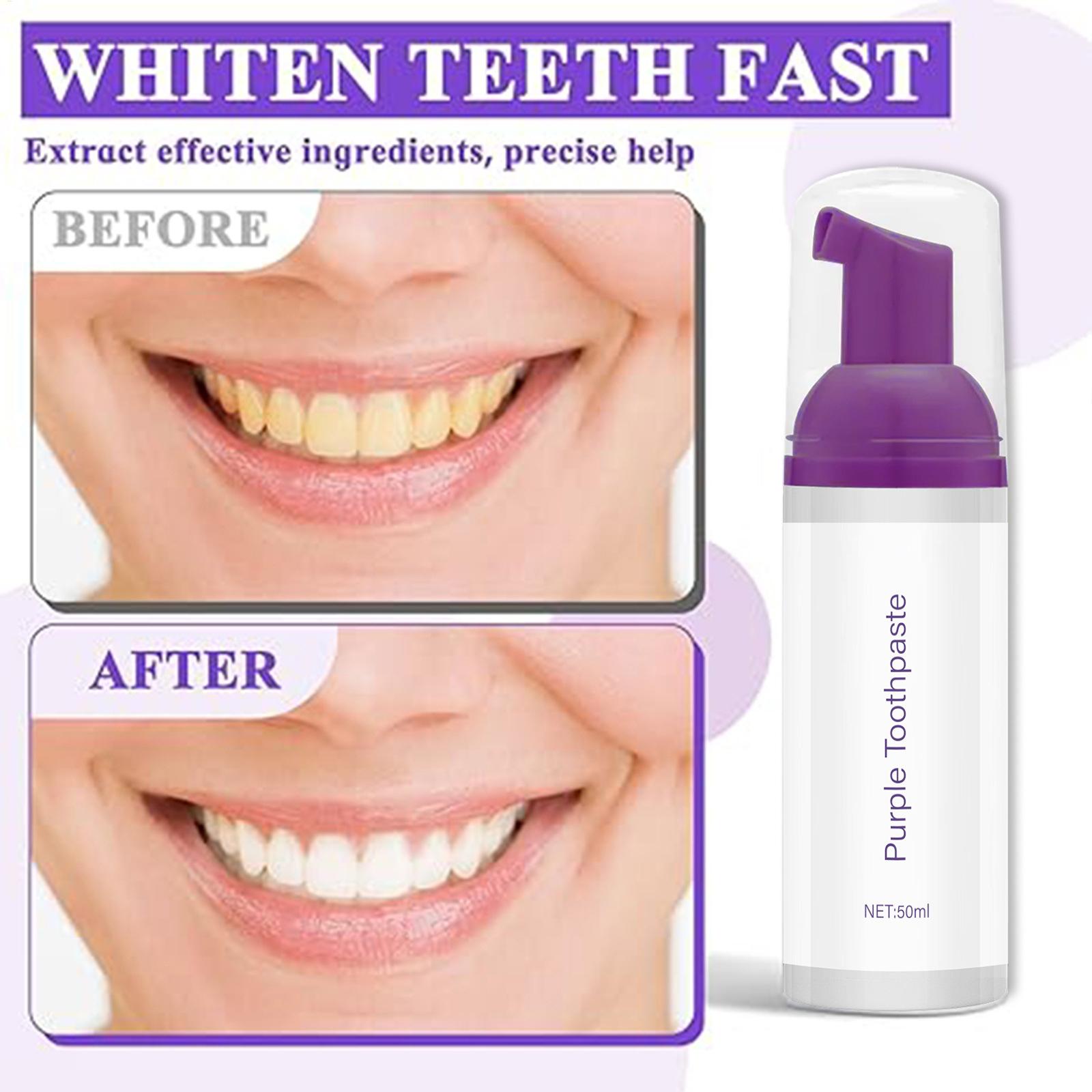 Teeth Whitening Before And After - 50ml Schuimtandpasta Verhelderende Dieptereiniging Ultrafijn Schuim