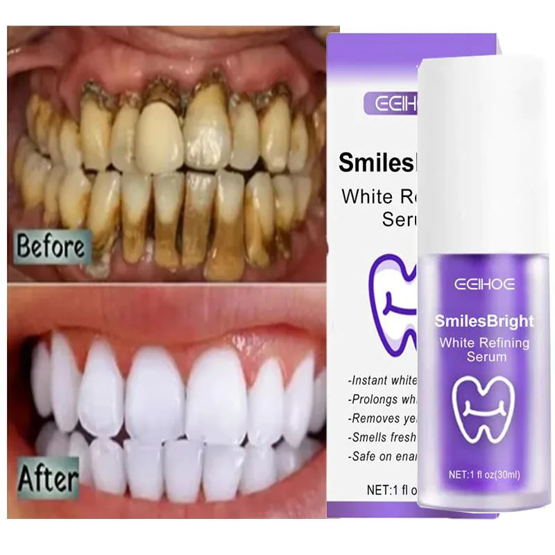 Teeth Whitening Korea - Tanden Reiniging Whitening Tandpasta Witter Gel