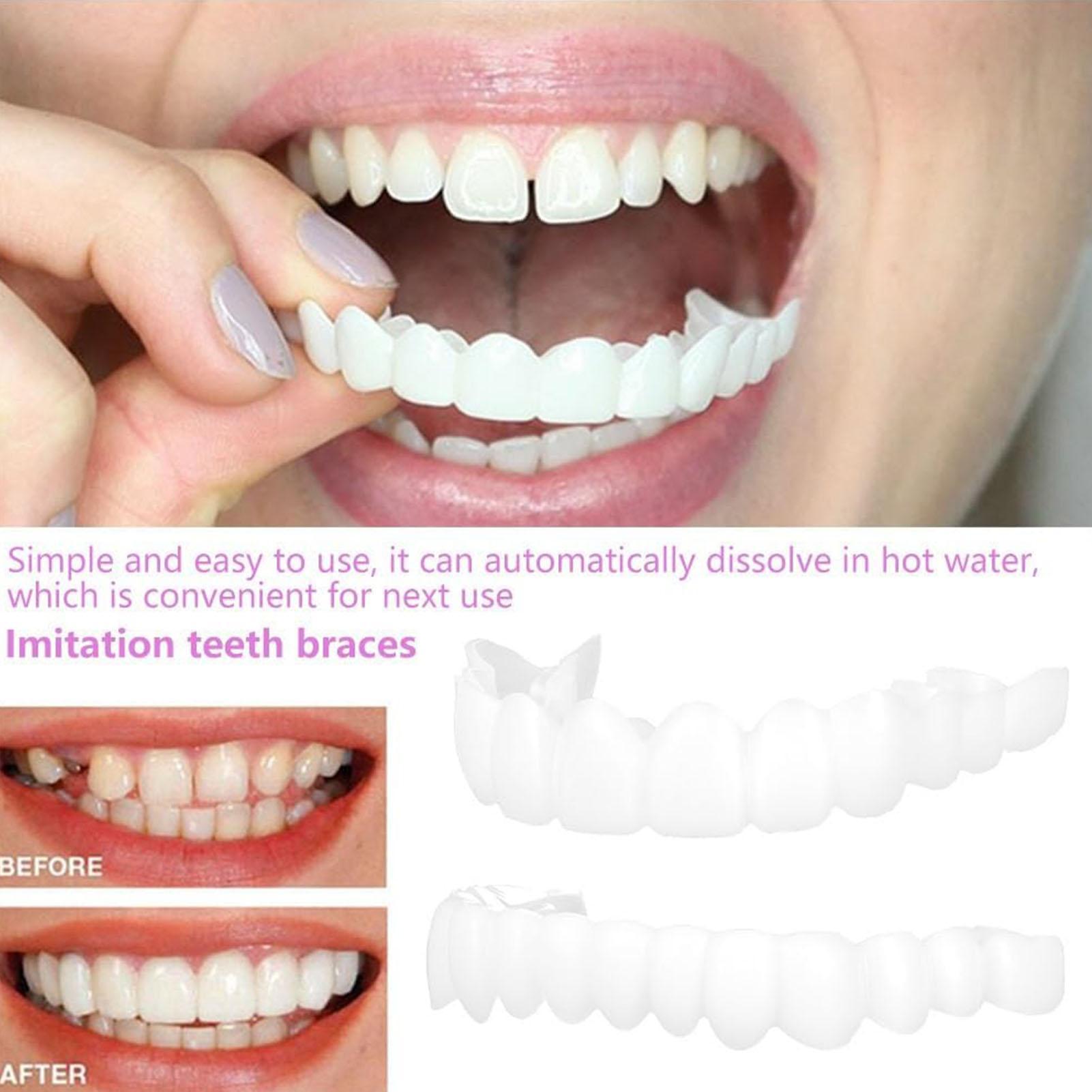 Teeth Whitening Mask - 2 Stuks Mannen Vrouwen Tijdelijke Tanden