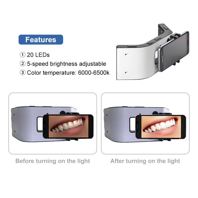 Met standaard dimbare tandheel - Teeth Whitening Before And After recensie en prijs