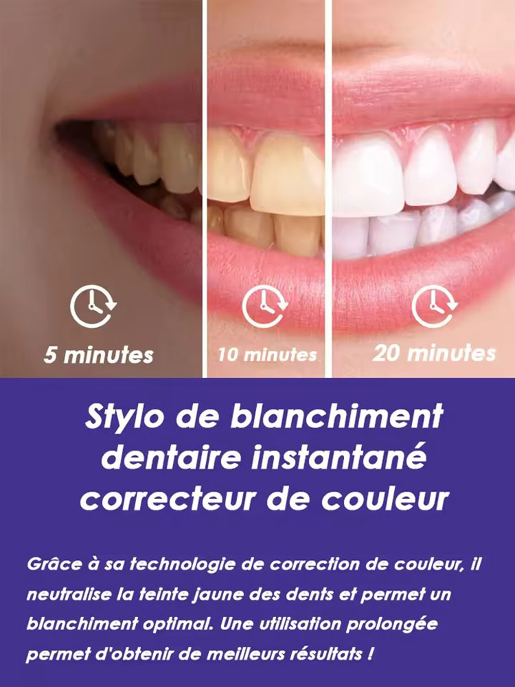 8ml*2 Tandenbleekpennenset Ora - Teeth Whitening Gel Pen recensie en prijs