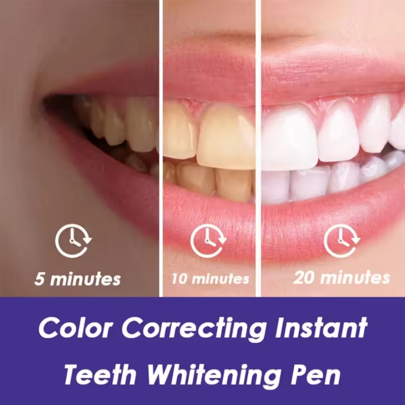 Magische Paarse Tandenbleekpen - Teeth Whitening Gel Pen recensie en prijs