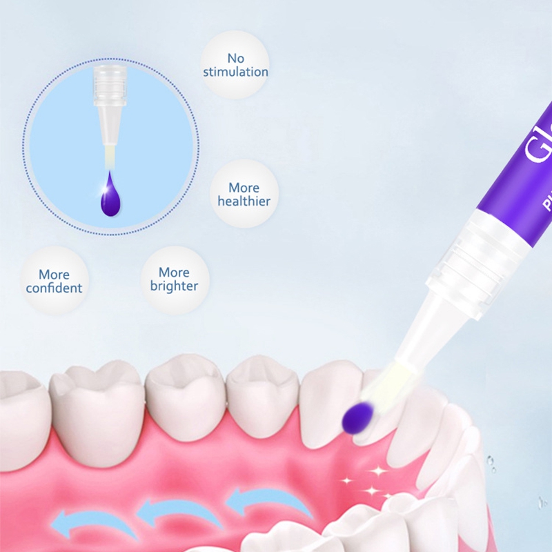 Magische Paarse Tandenbleekpen - Teeth Whitening Gel Pen recensie en prijs