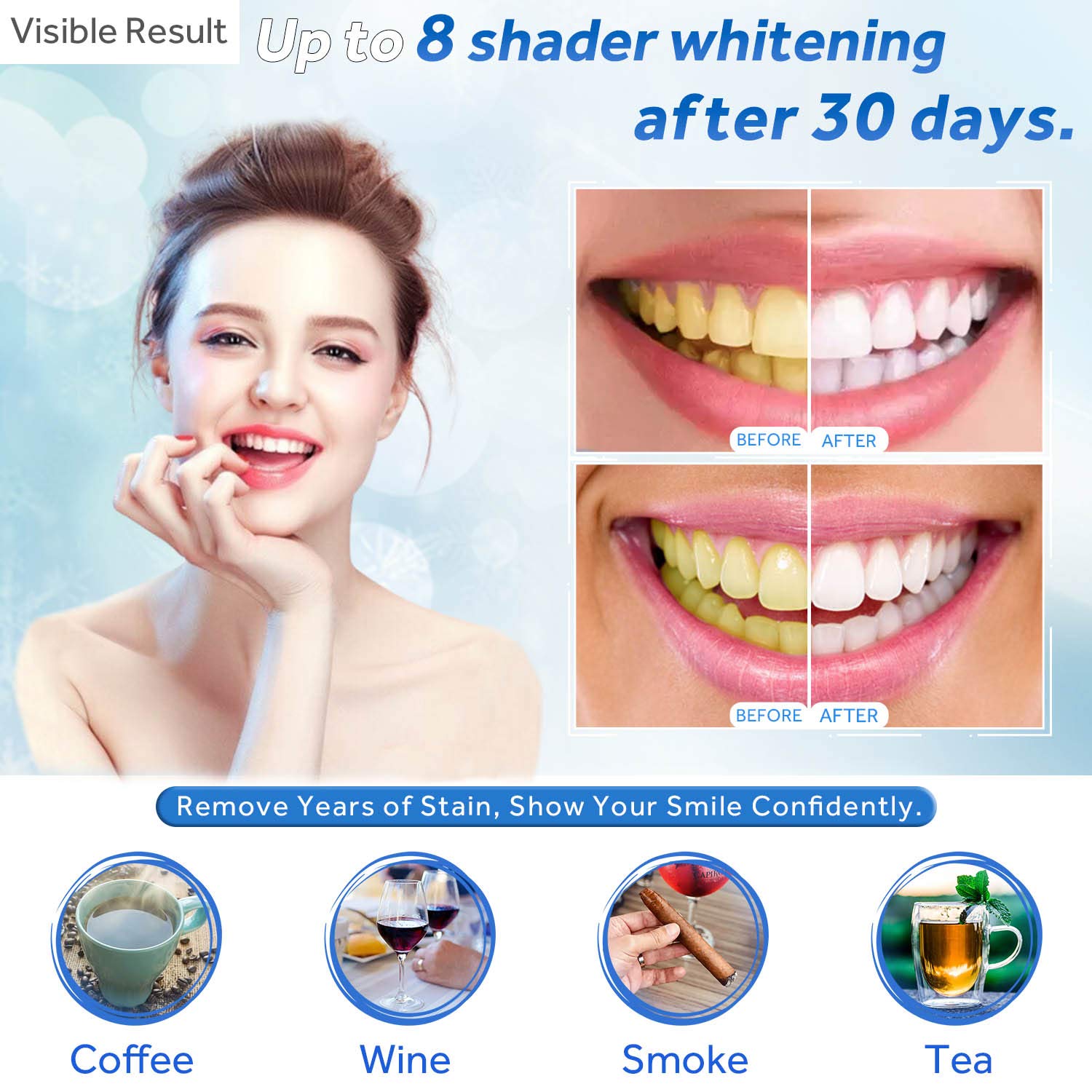 Tanden Whitening Gel Refill Sp - Teeth Whitening Mask recensie en prijs