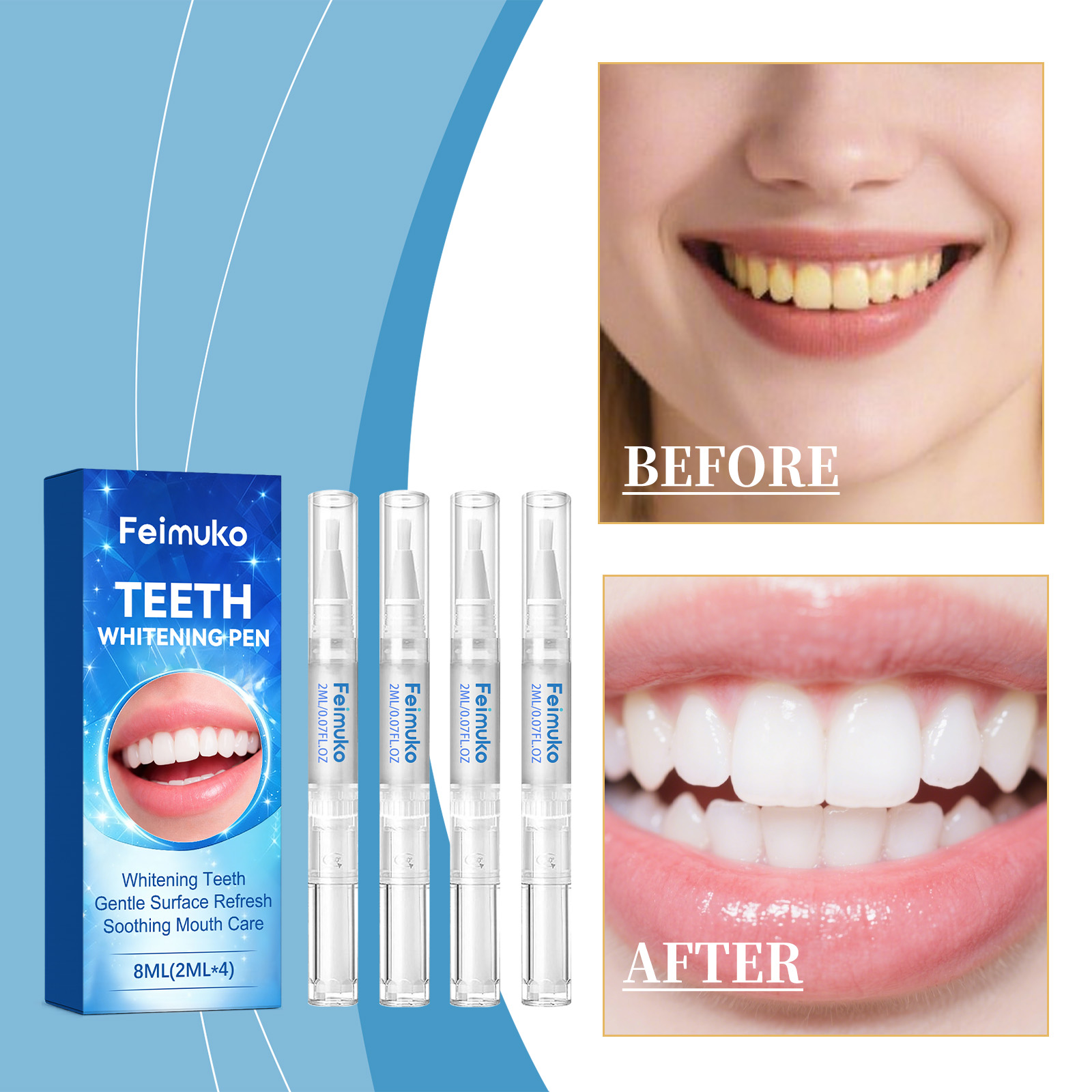Feimuko 8ml Tandengelpen Zacht - Teeth Whitening Gel Pen recensie en prijs
