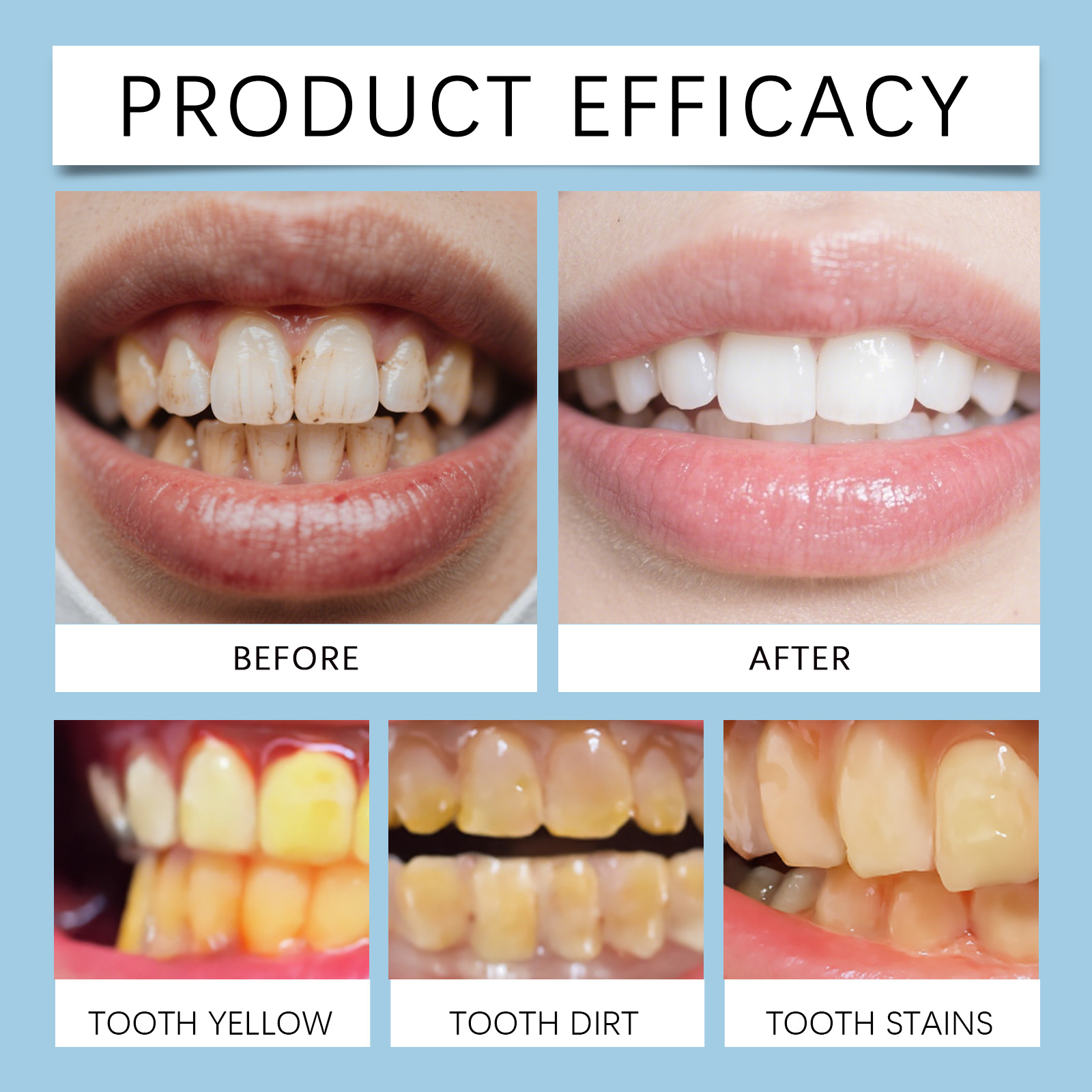 Feimuko 8ml Tandengelpen Zacht - Teeth Whitening Gel Pen recensie en prijs