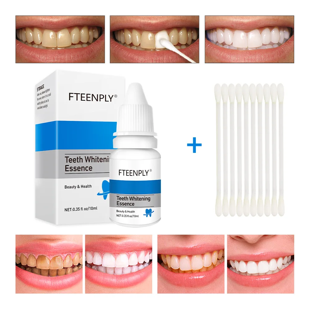 Fteenply Tanden Whitening Esse - Teeth Whitening Vape recensie en prijs