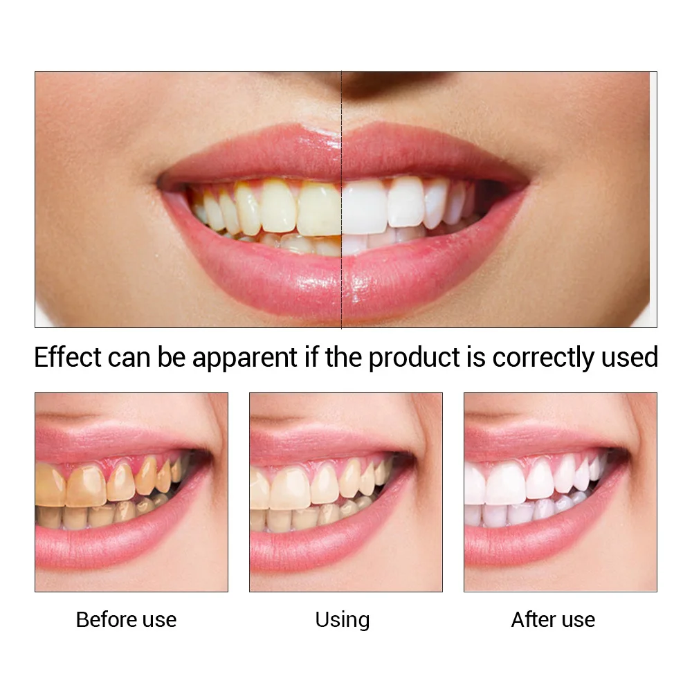 Fteenply Tanden Whitening Esse - Teeth Whitening Vape recensie en prijs