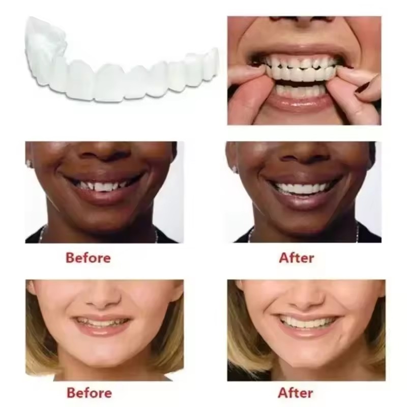 Tanden Veneers Bleekmiddelen P - Teeth Whitening Vape recensie en prijs