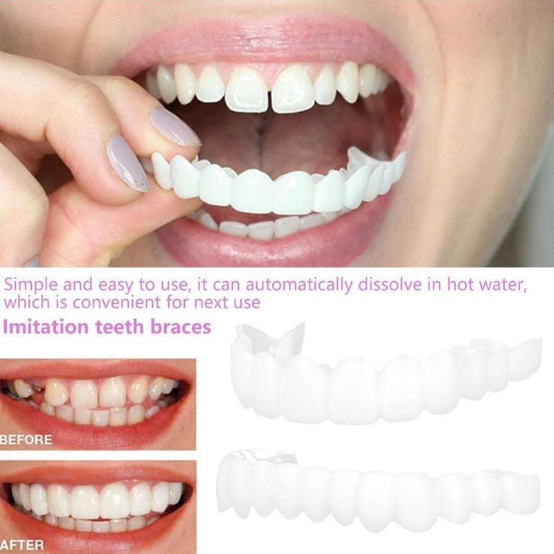 Klik op tanden fineer Instant  - Teeth Whitening Mask recensie en prijs