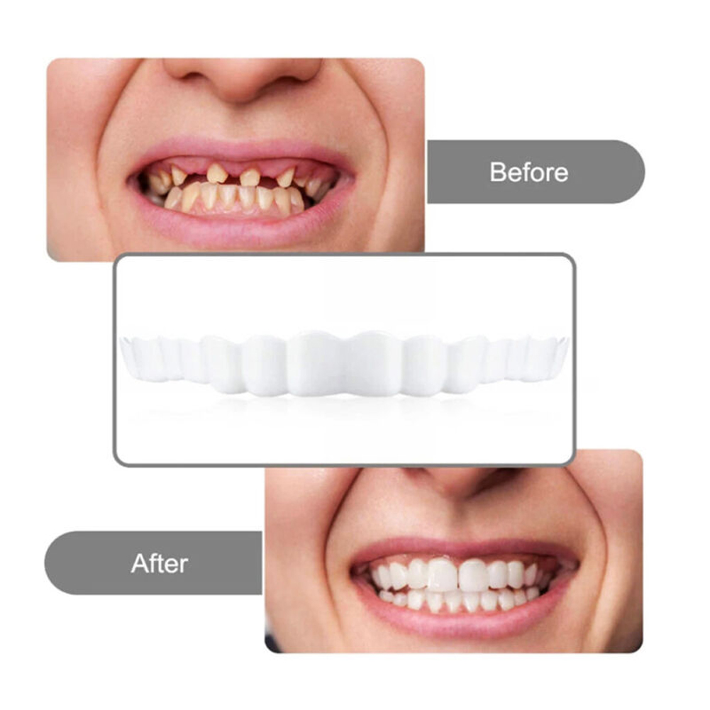 4-6 paar boven- en onderkaak k - Teeth Whitening Mask recensie en prijs