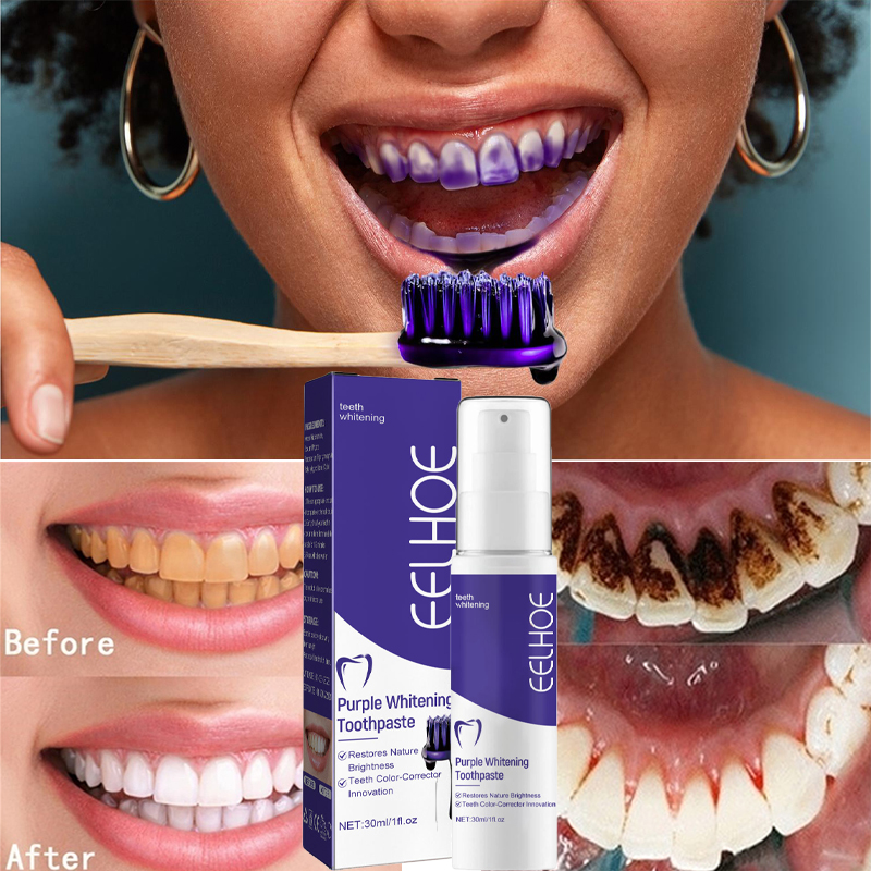 1 Stuks Tanden Reinigen Tandpa - Teeth Whitening Korea recensie en prijs