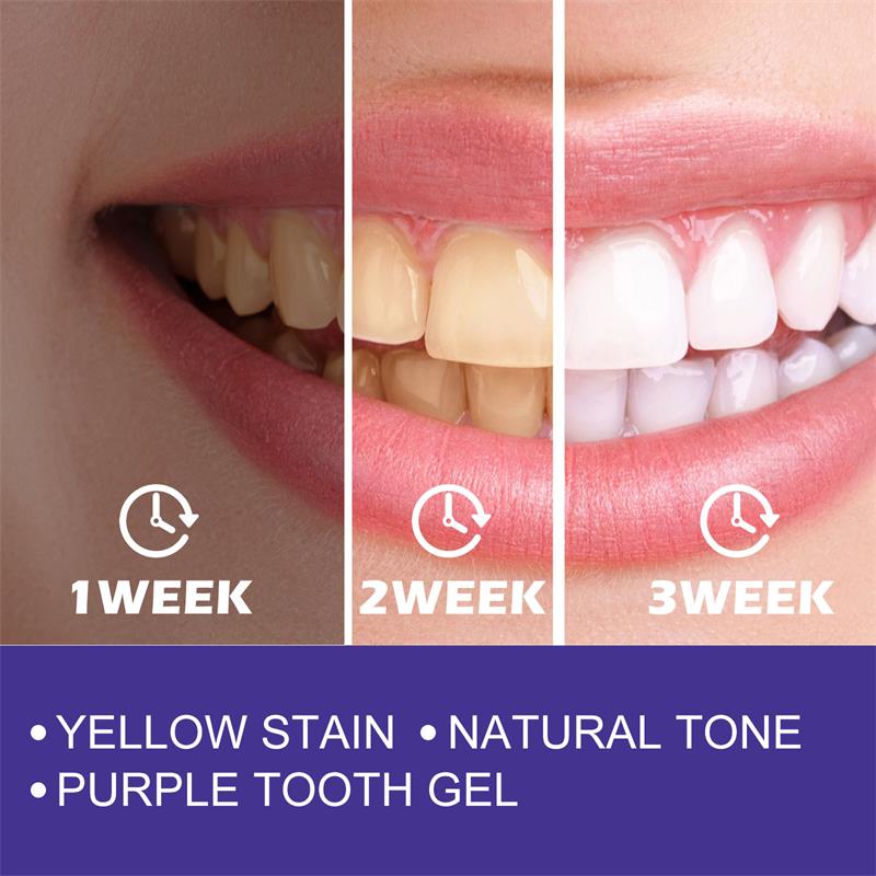 1 Stuks Tanden Reinigen Tandpa - Teeth Whitening Korea recensie en prijs