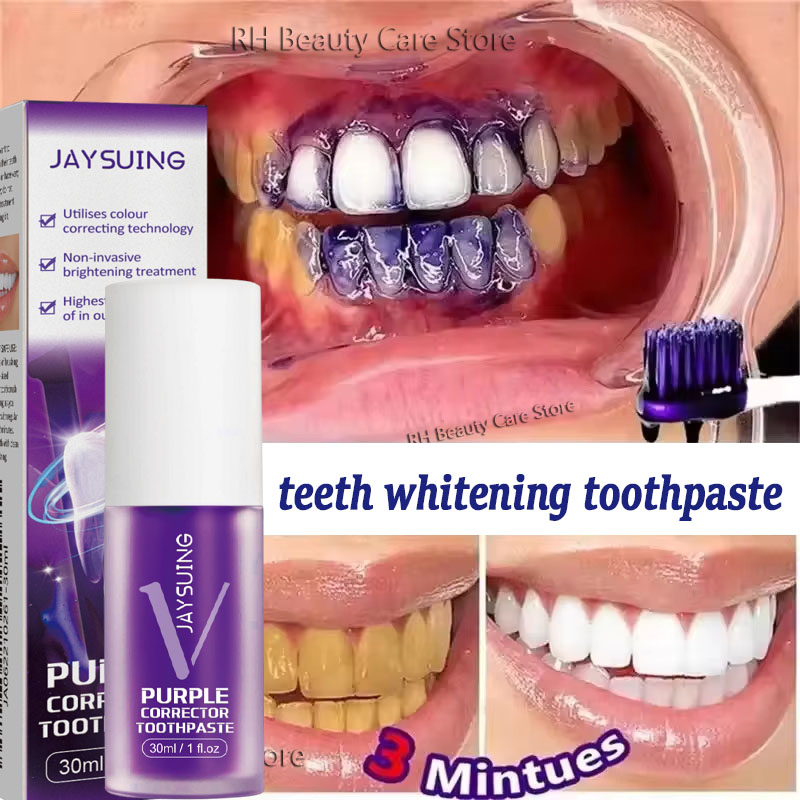 Tandenreiniging Whitening Tand - Teeth Whitening Korea recensie en prijs