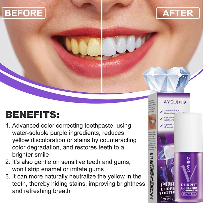 Tandenreiniging Whitening Tand - Teeth Whitening Korea recensie en prijs