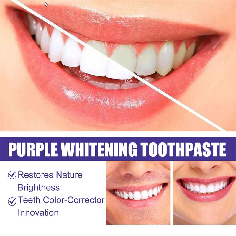 Tandenreiniging Whitening Tand - Teeth Whitening Korea recensie en prijs