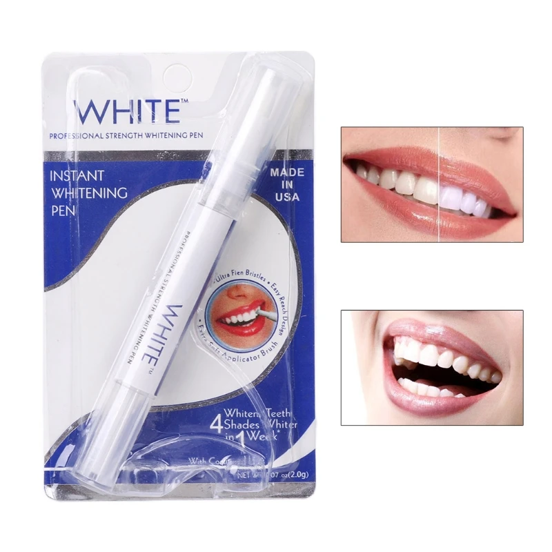 Instant White Teeth Whitening  - Teeth Whitening Gel Pen recensie en prijs