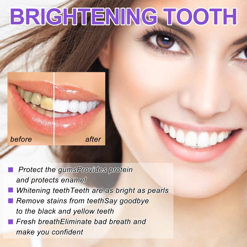 Tanden Reiniging Whitening Tan - Teeth Whitening Korea recensie en prijs