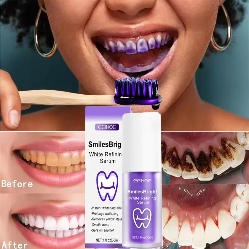 Tanden Reiniging Whitening Tan - Teeth Whitening Korea recensie en prijs