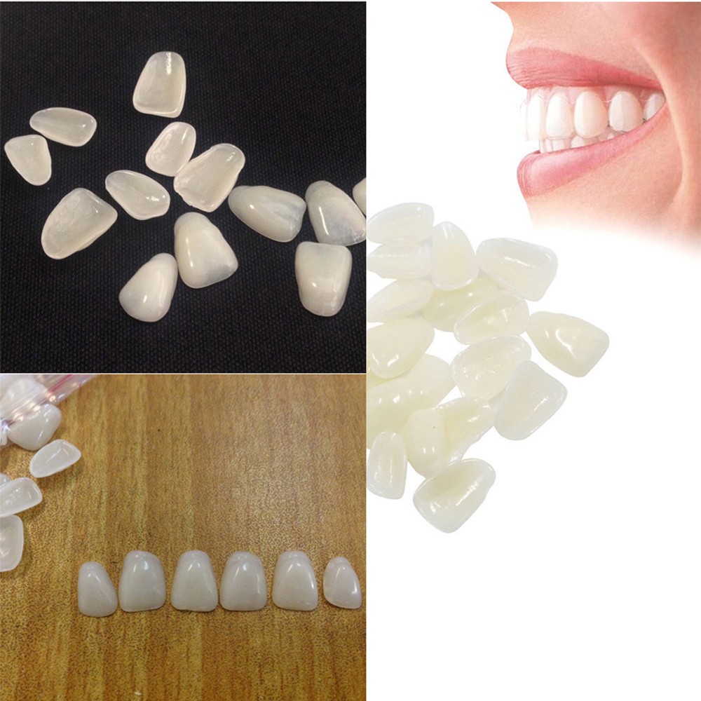 70 stuks/verpakking Beauty Ven - Teeth Whitening Mask recensie en prijs