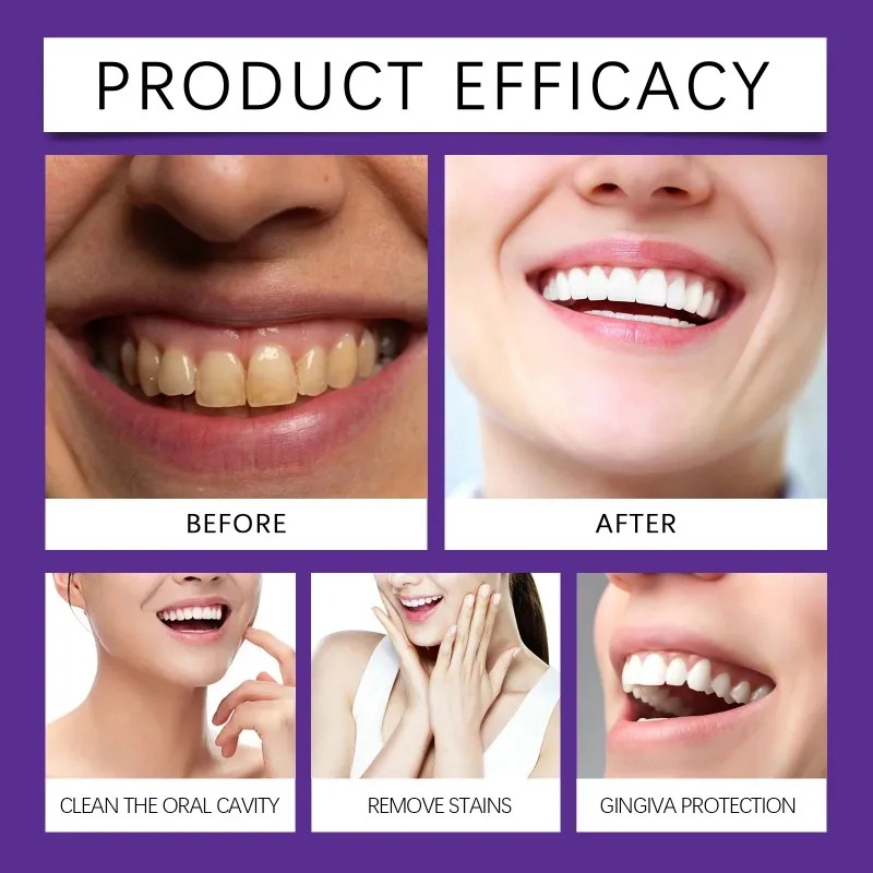 Paarse Tandrestauratie Mineral - Teeth Whitening Instant recensie en prijs