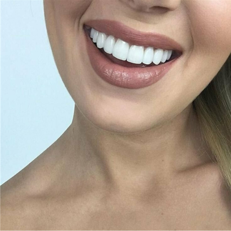 Tanden bleken Veneers Tijdelij - Teeth Whitening Mask recensie en prijs