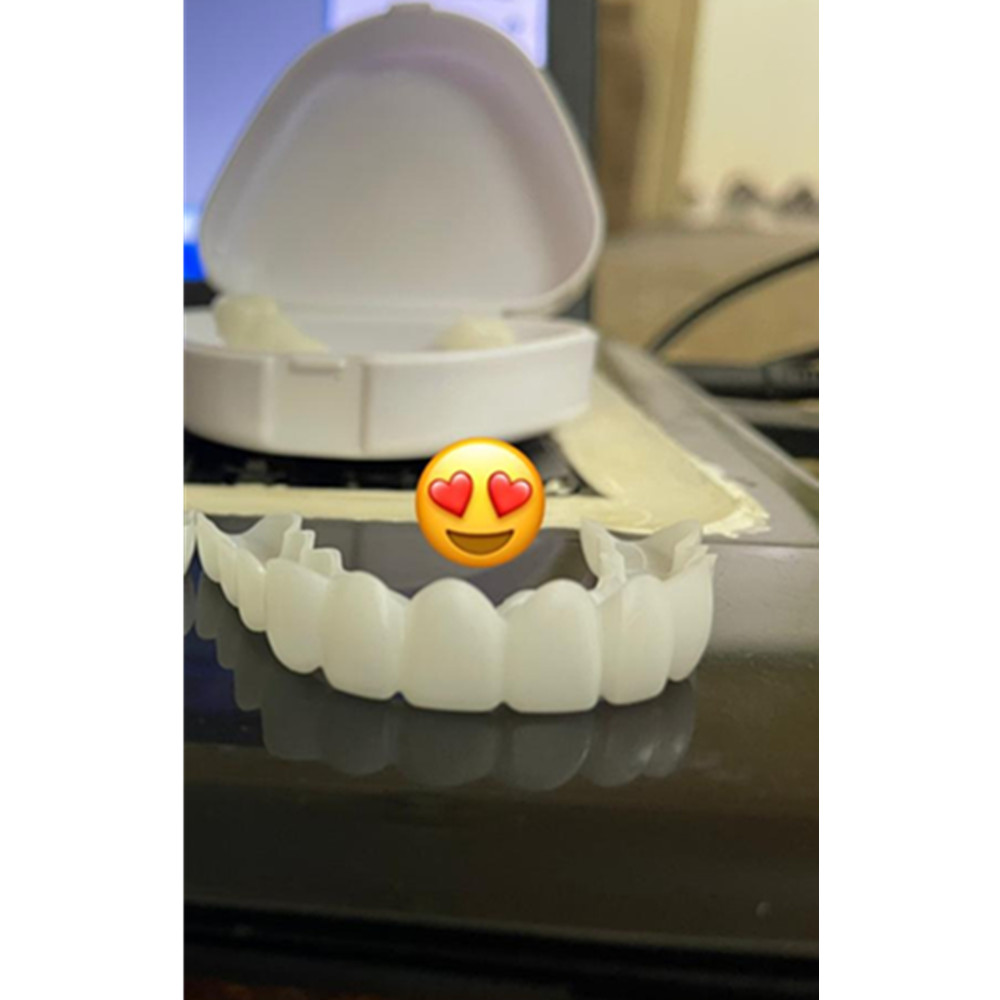 On Smile Dental Boven- en Onde - Teeth Whitening Mask recensie en prijs