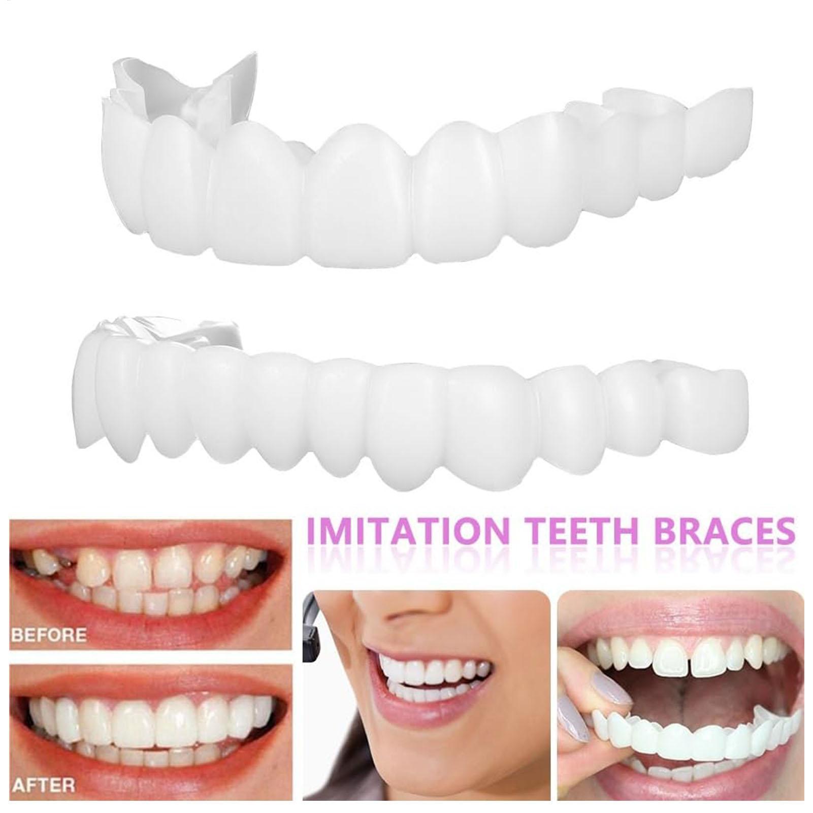 2 Stuks Mannen Vrouwen Tijdeli - Teeth Whitening Mask recensie en prijs