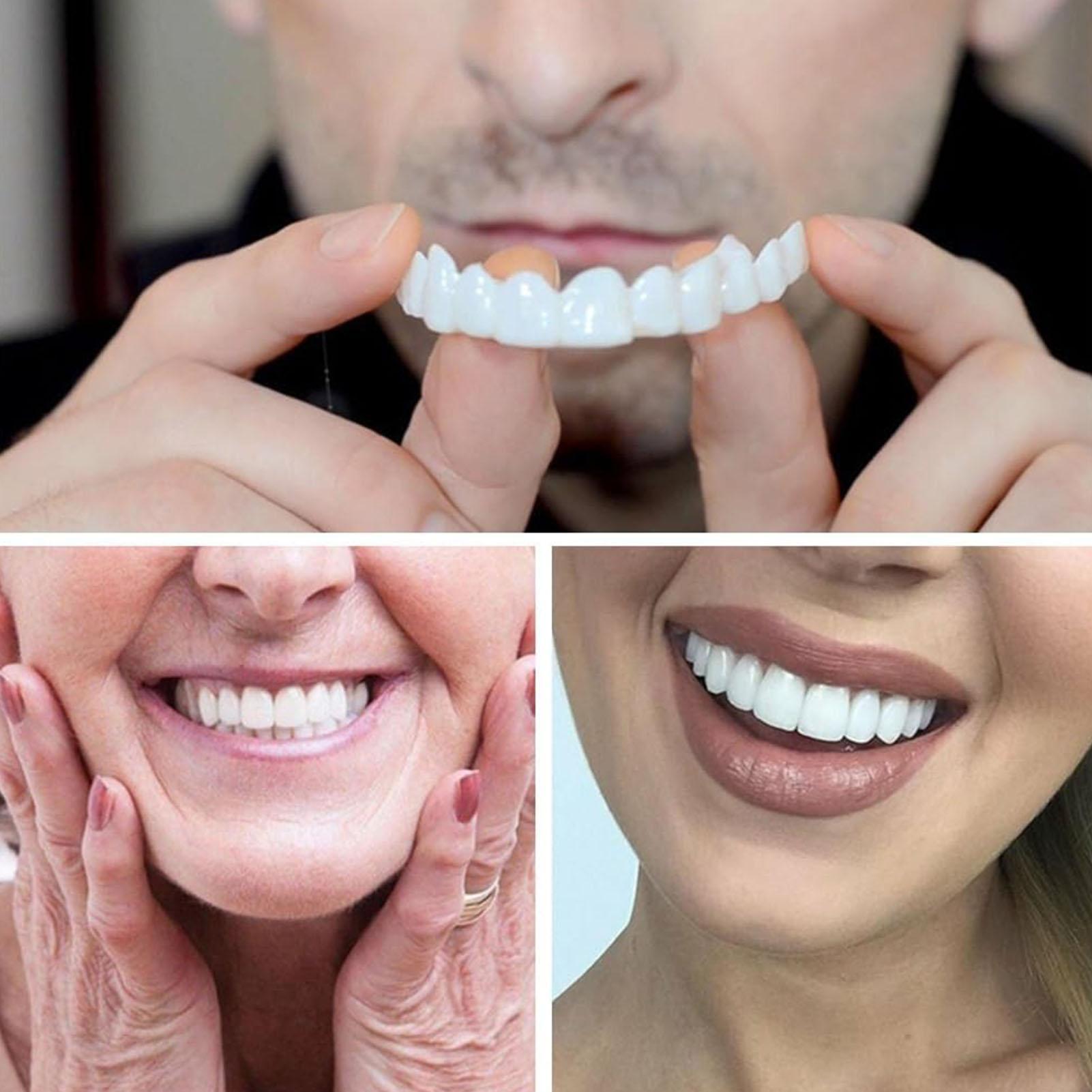 2 Stuks Mannen Vrouwen Tijdeli - Teeth Whitening Mask recensie en prijs
