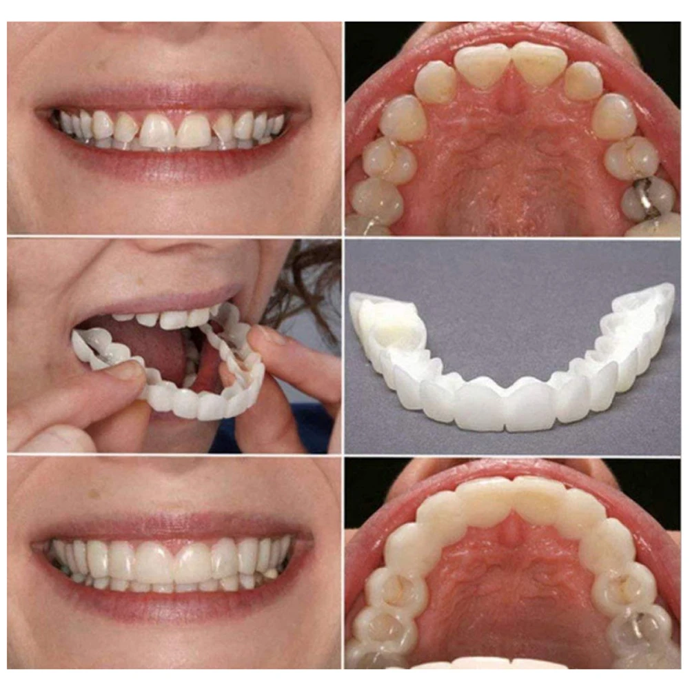 2 Paar Kunstgebittanden Kunstg - Teeth Whitening Mask recensie en prijs